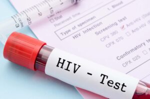 'Lucky to still be alive':  Living with HIV for over 30 years